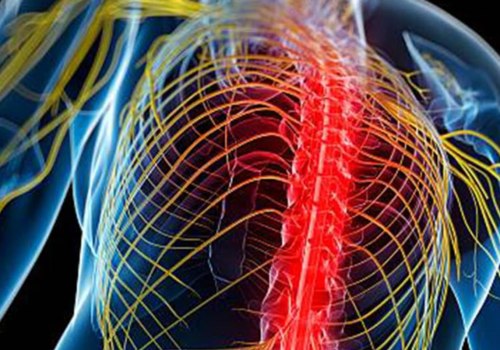What is neuro pain management?